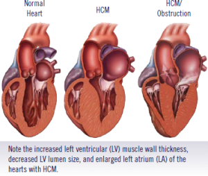 HCM